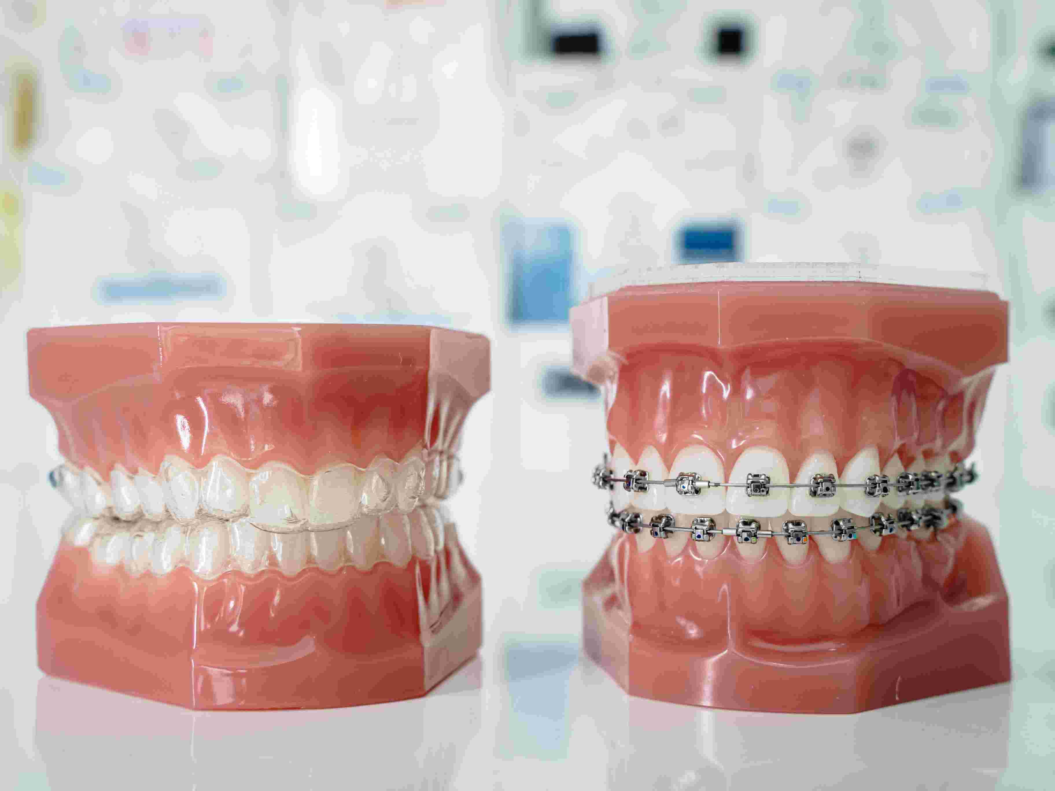 Dental procedure showing root canal treatment
